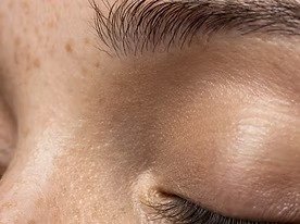 imgi_6_young-woman-skin-texture-side-view